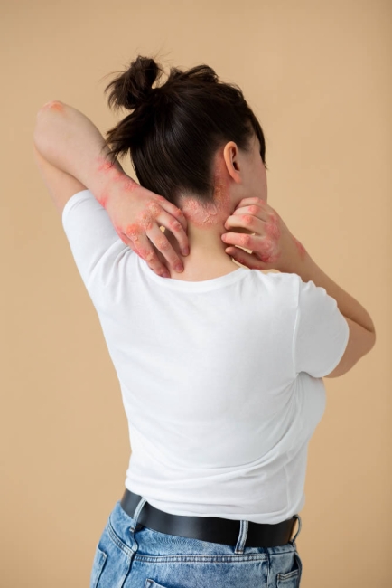 Rashes or Skin Issues