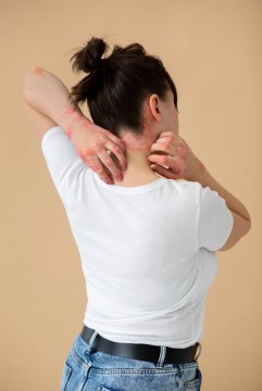 Rashes or Skin Issues